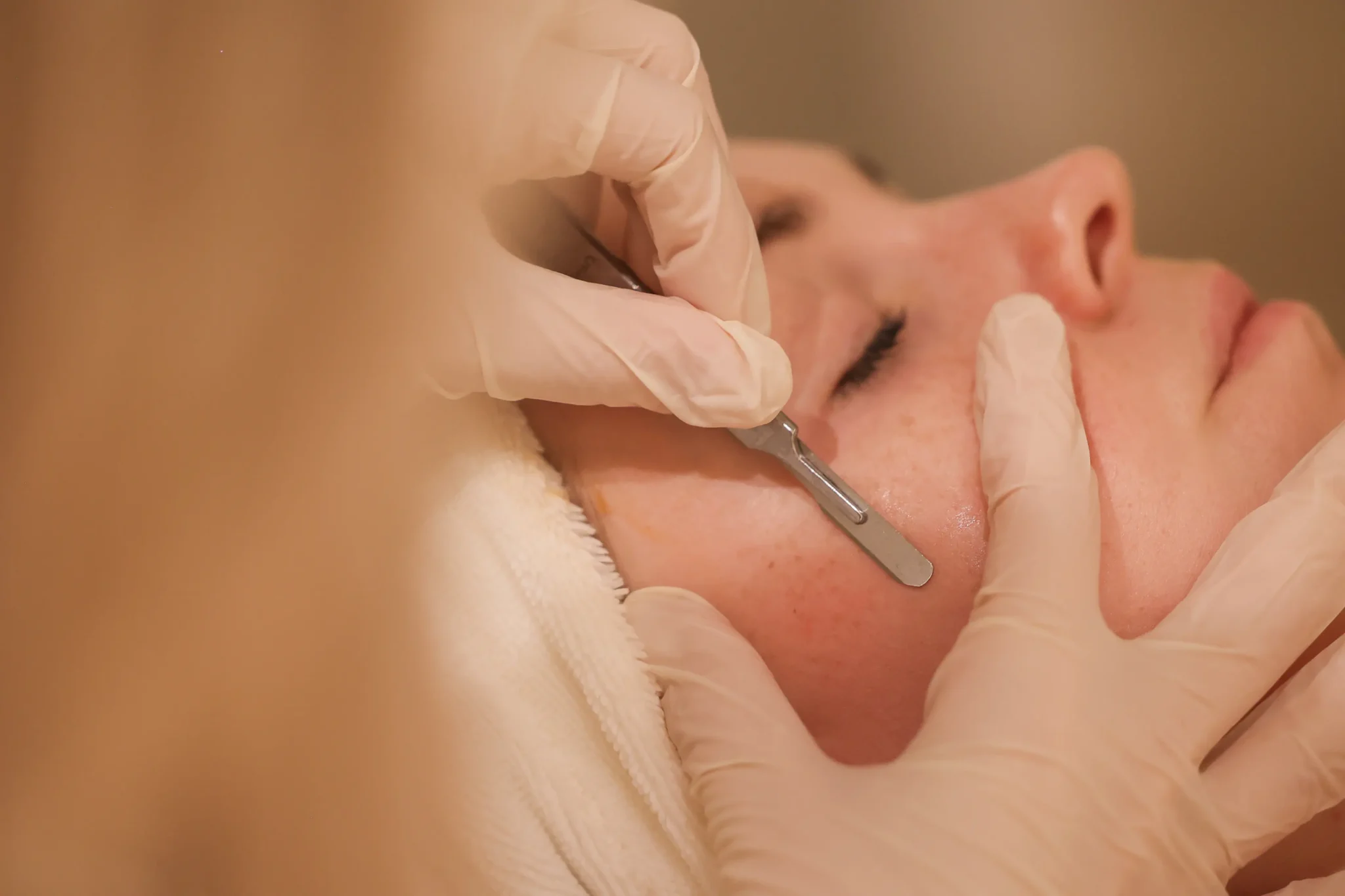Bij Sarah J in Bree bieden we Dermaplaning